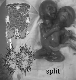 Drag Queen Fuckfest : Drag Queen Fuckfest - Infected Gastroenteritis